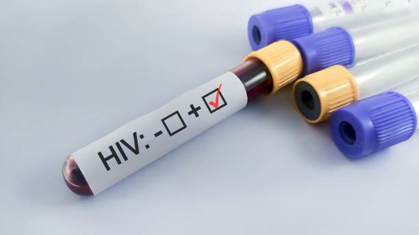 Same Day HIV Test Result Bangkok